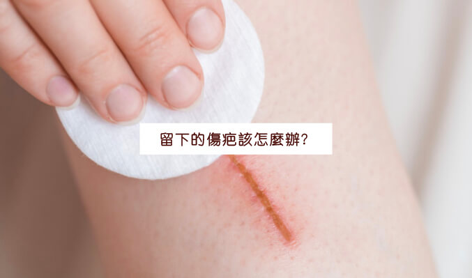 傷口留下的疤痕該怎麼辦？ 2