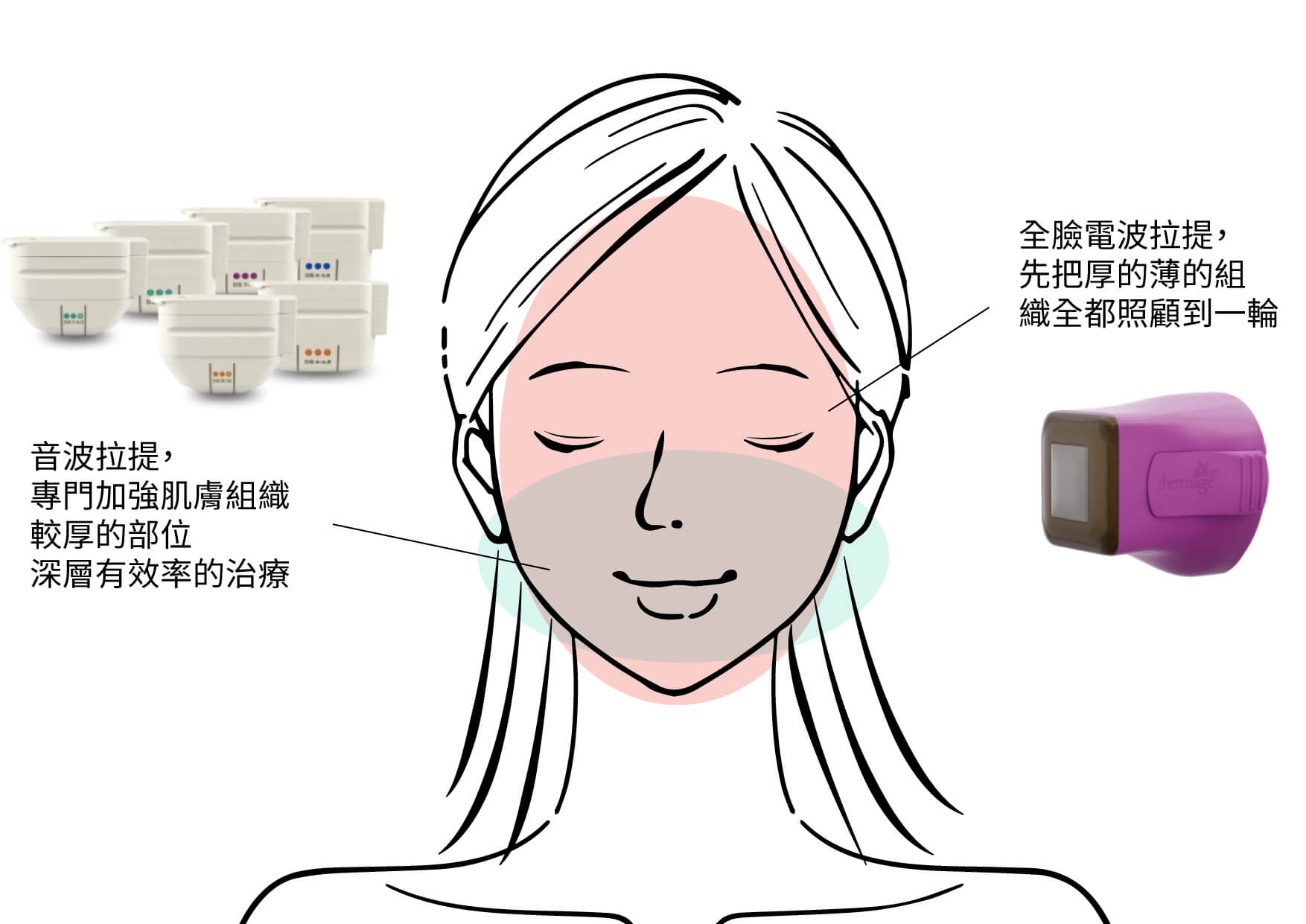 電音波搭配治療-01