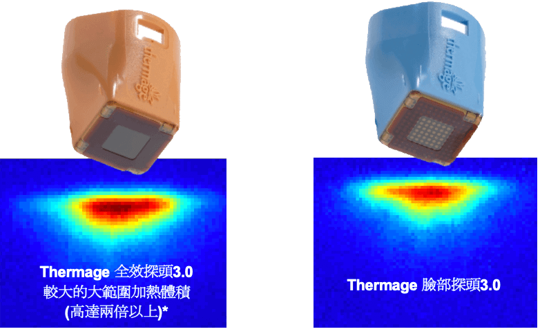 CPT電波拉皮 大範圍加熱的優點