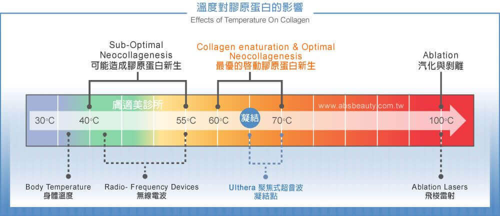 Ulthera超音波拉提兩大特點