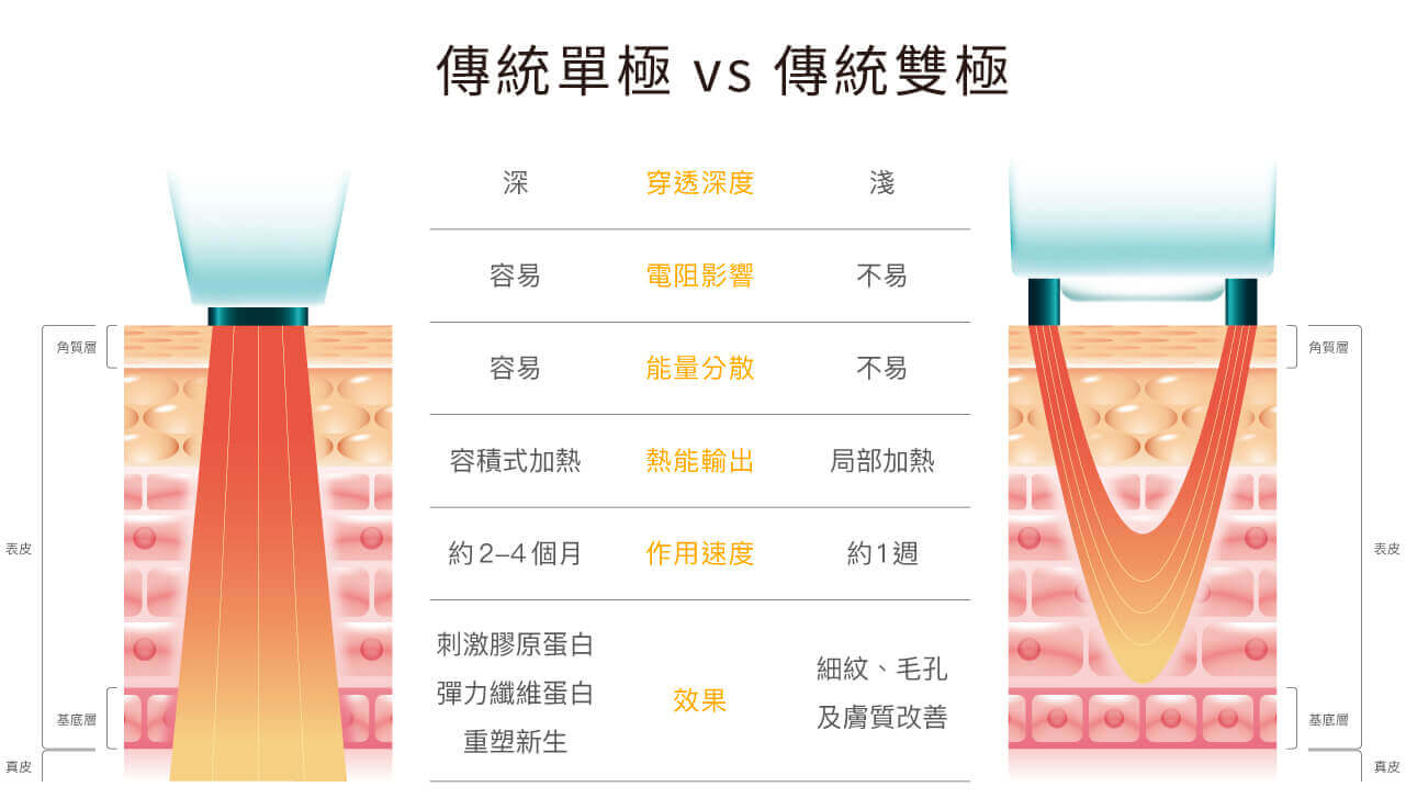無雙電波2_傳統單極 vs 傳統雙極