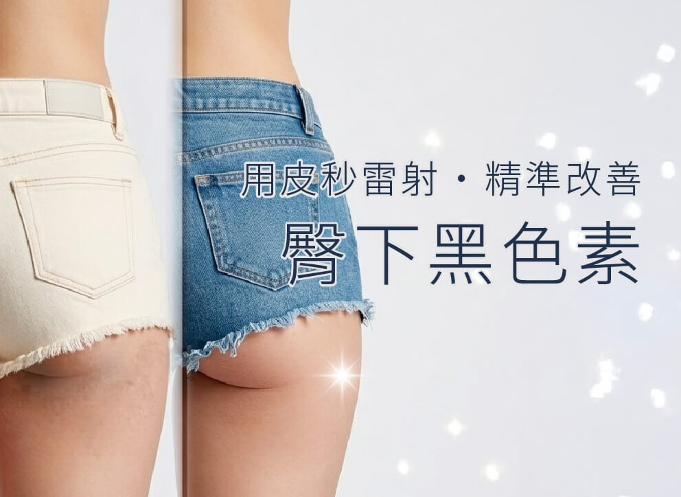 臀下黑色素拷貝