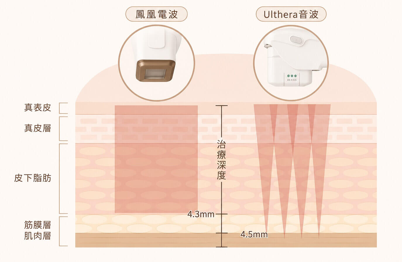 電波音波比較